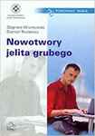 NOWOTWORY JELITA GRUBEGO-PZWL